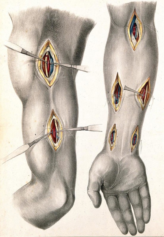 Medicine