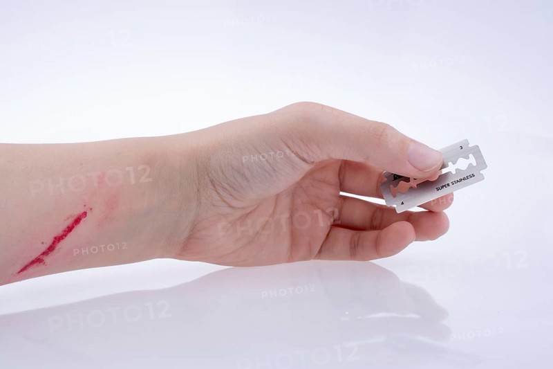 Injured hand holding a razor blade on a white background
