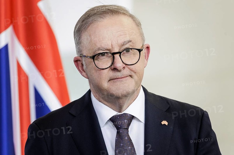 Anthony Albanese