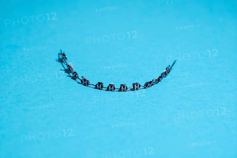 Fixed braces of a child on a blue background