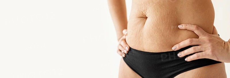 Woman body with