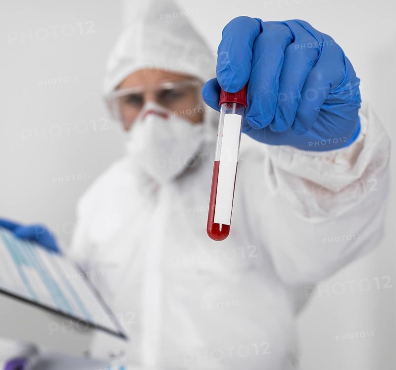 Doctor holding covid sample
