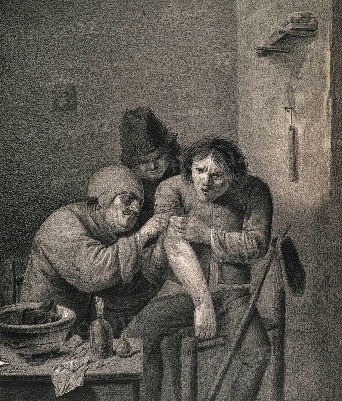 A surgeon dresses the wound of a grimacing patient