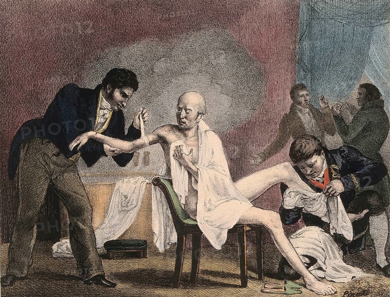 An emaciated old man being treated by four doctors