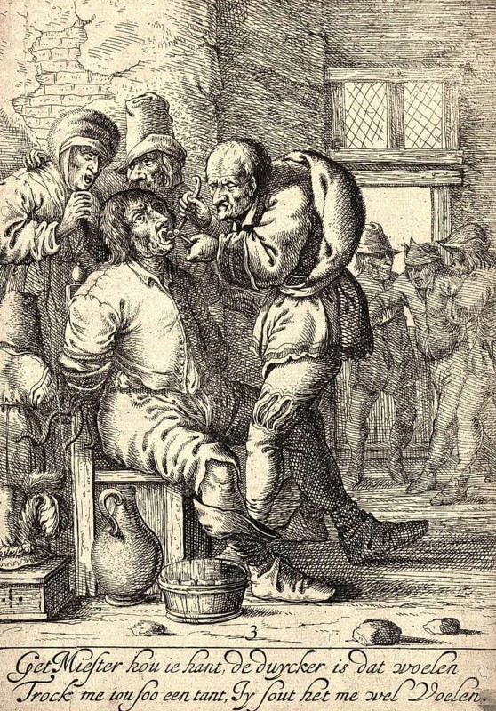 A dental extractor pulls a tooth from a patient tied to a chair in a rundown room while his worried woman looks on. Dental instruments and apparatus. Dentist and Patient