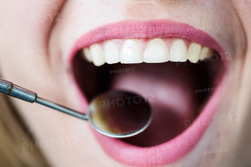 Open mouth woman with dentist mirror