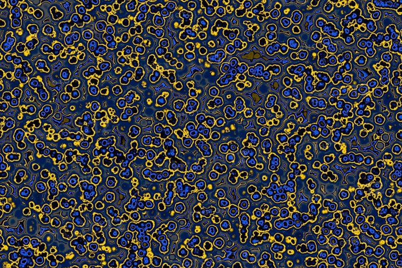Shape of bacterial cell: cocci