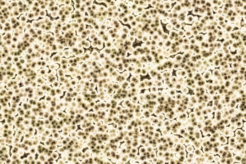 Shape of bacterial cell: cocci
