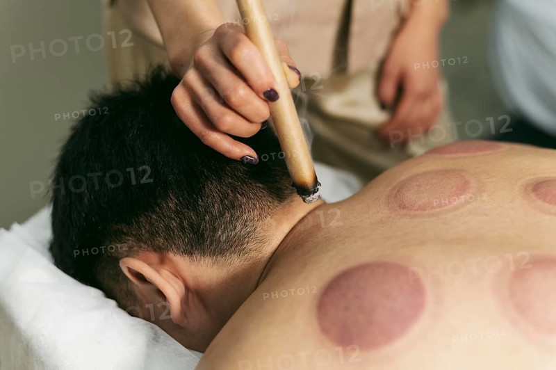 Suction cups therapy session close up