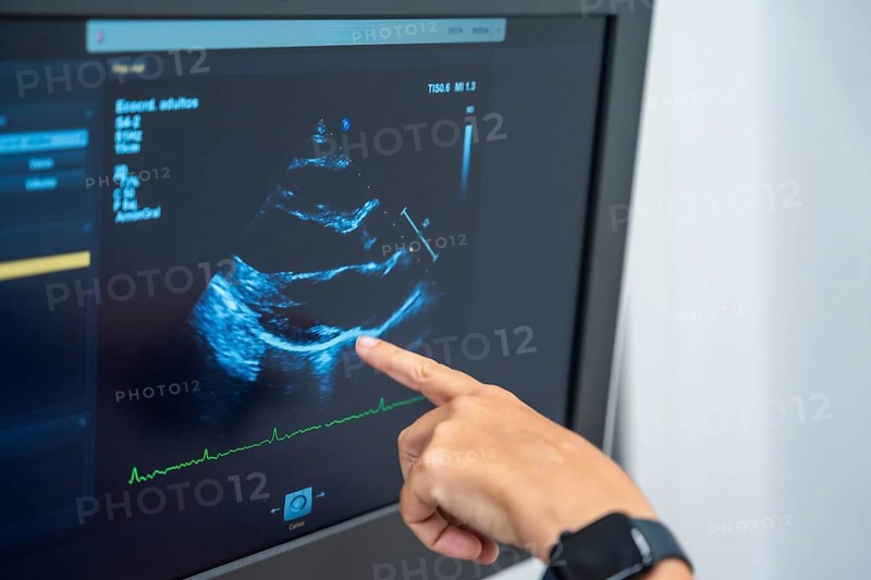 Cardiology clinic with a new ultrasound machine for echocardiogram exams to clients