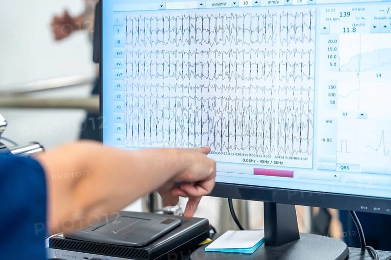 Cardiologist pointing to the data on the computer while man performing a cardiovascular stress test in the hospital