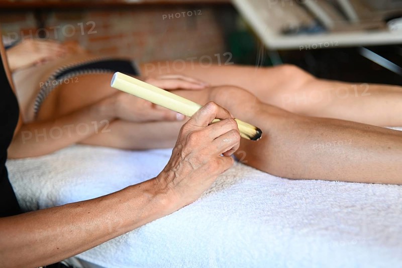 Therapist apply abdominal moxibustion chinese smoking stick moxa medicine burn mugwort in acupuncture point to caucasian adult fit woman to facilitate blood flow and general health through qi oriental meridian point
