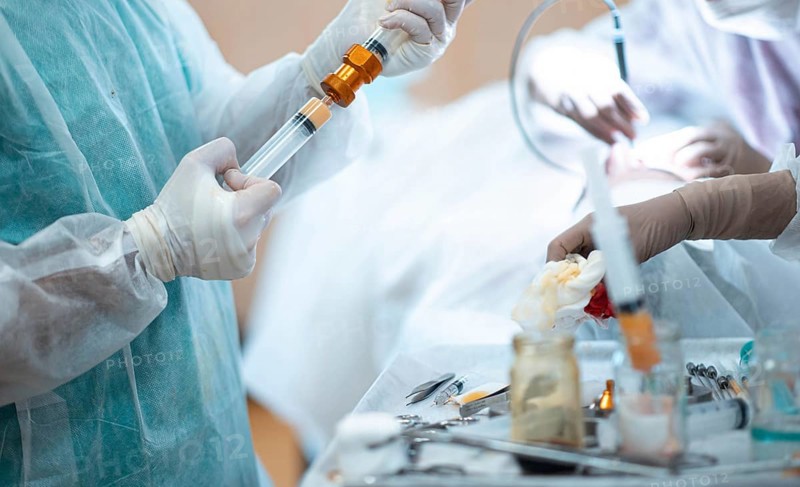 Liposuction and lipofilling concept