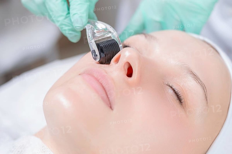 Portrait of a woman's face with problem skin. Peeling procedure. Natural beauty.