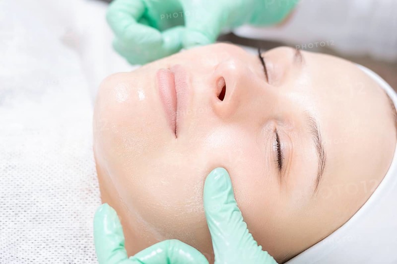 Portrait of a woman's face with problem skin. Peeling procedure. Natural beauty.