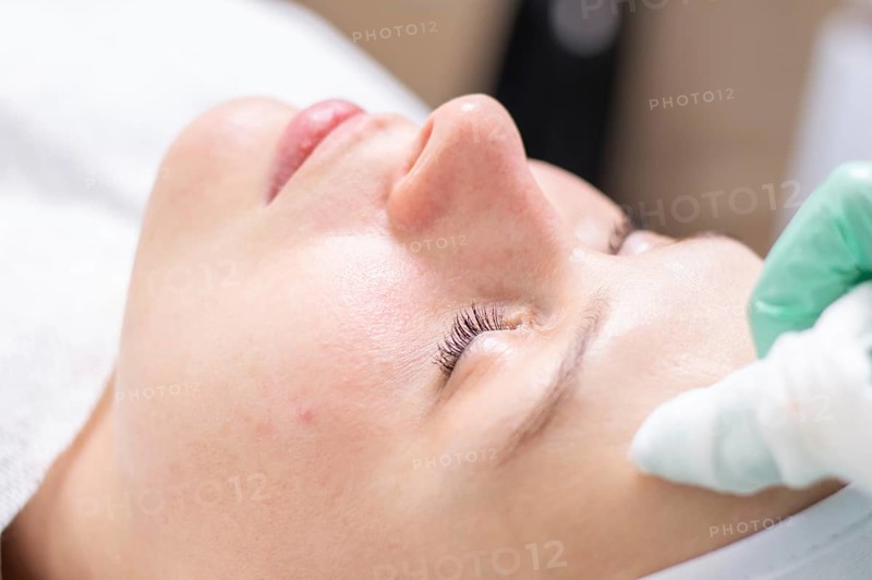 Portrait of a woman's face with problem skin. Peeling procedure. Natural beauty.