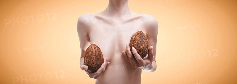 Woman posing in the studio with coconuts in her hands. Plastic surgery concept. Mammalogy. Silicone implants.