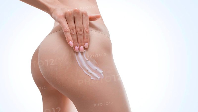 Image of female thighs with stretch marks on the skin. Prevention of treatment with natural ointments. Organic medical products.