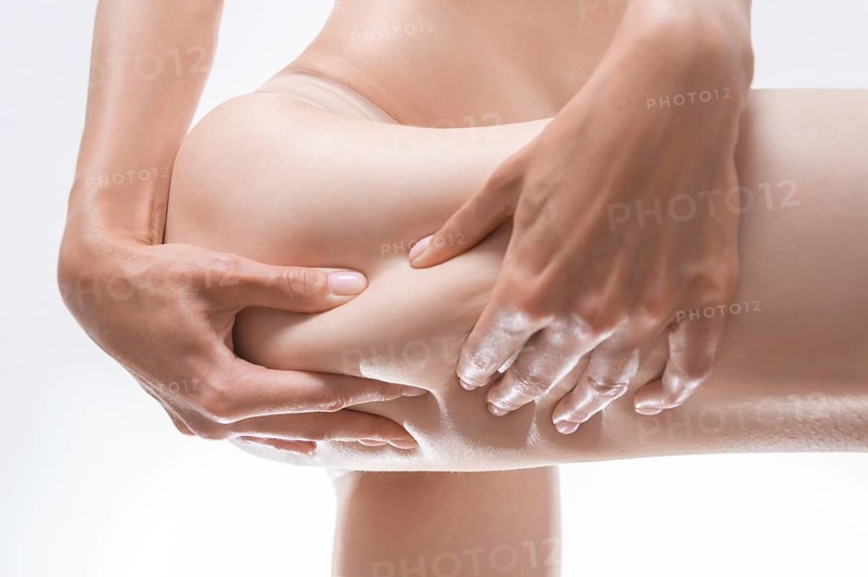 Image of a woman squeezing the skin on her thigh. Cosmetic concept.