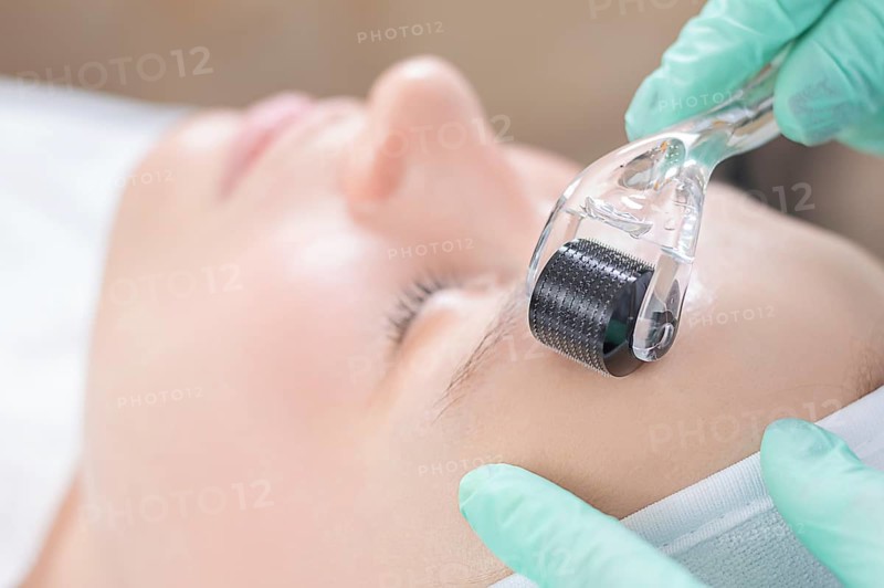 Portrait of a woman's face with problem skin. Peeling procedure. Natural beauty.