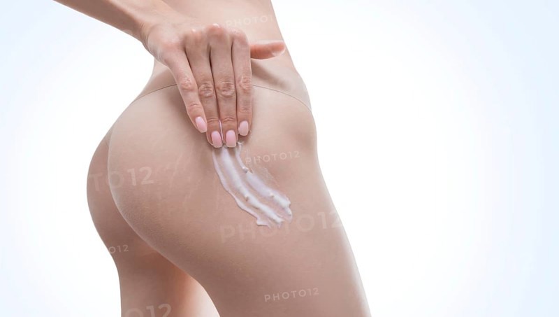 Image of female thighs with stretch marks on the skin. Prevention of treatment with natural ointments. Organic medical products.