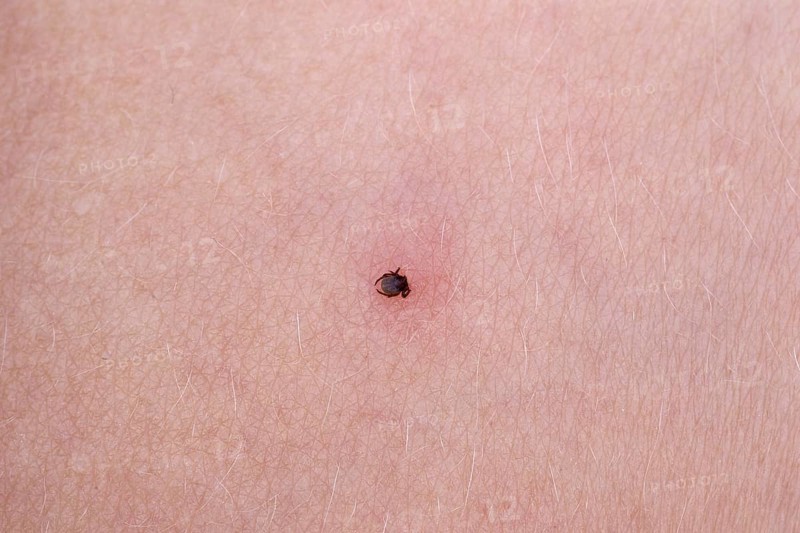 Castor bean tick