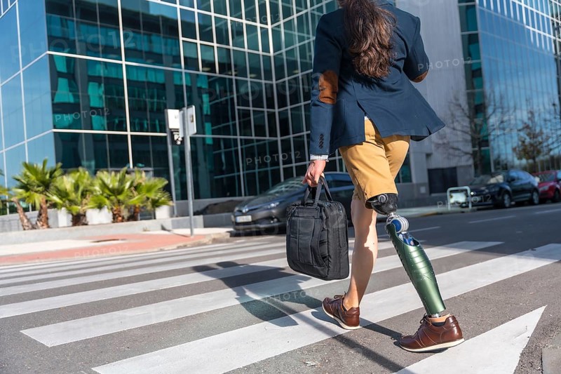 Rear view of a businessman with prosthetic leg in the city