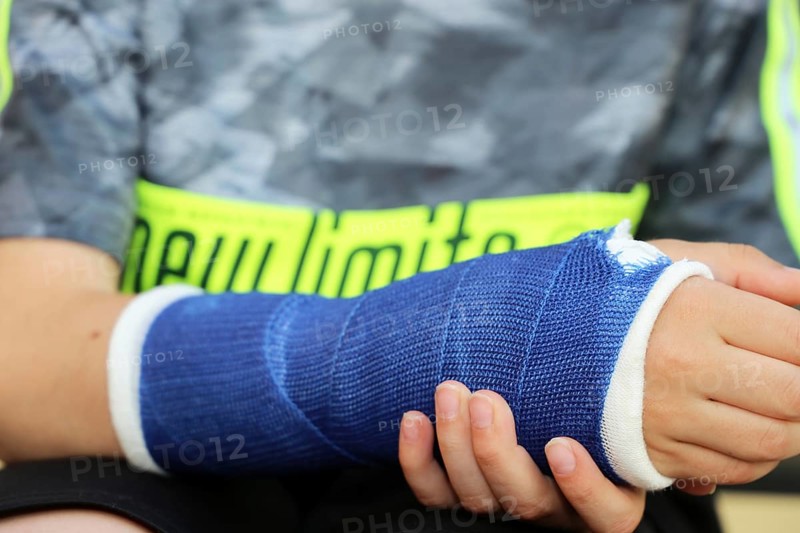 Close-up of a boy with an arm in plaster