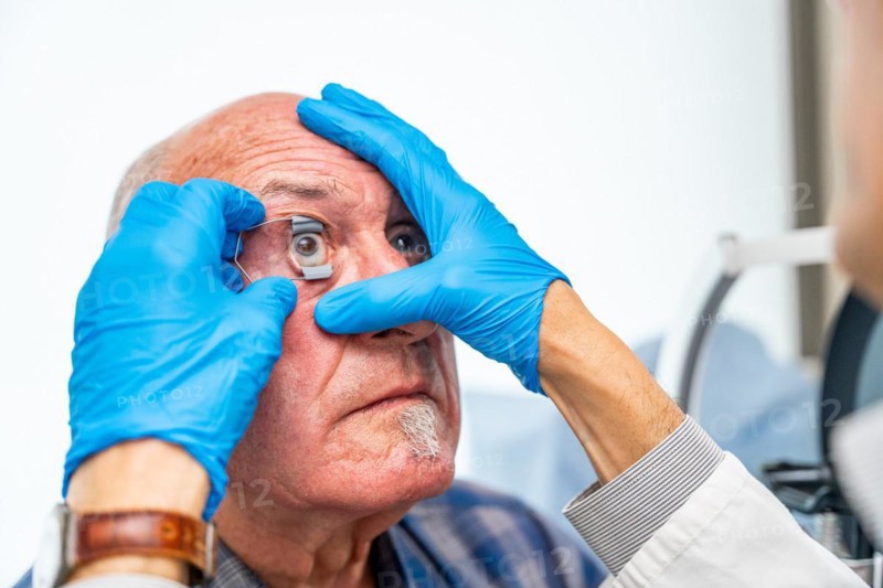 Ophthalmologist applying an eye opener on a senior patient before an innovative treatment for glaucoma