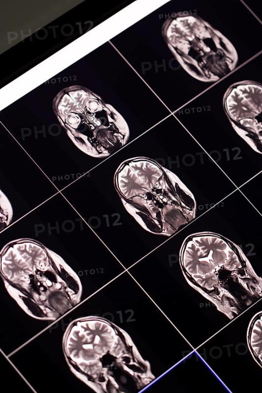 Multiple brain MRI scans on a monitor during a medical examination