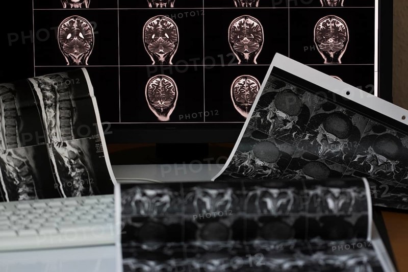 A collection of various MRI images and X-ray images of the brain, including images of a screen and several printed scans of a person's spine