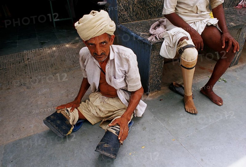 Double leg amputee waiting for a prosthesis called Jaipur foot (or leg), leg amputee with a Jaipur leg prosthesis, Jaipur, Rajasthan, India, Asia