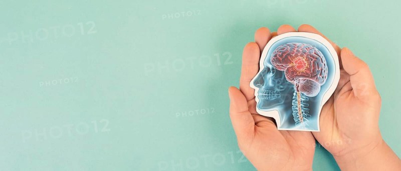 Human brain x-ray, epilepsy, tumor, migraine headache attack, psychological pressure and stress, mind with burnout or trauma