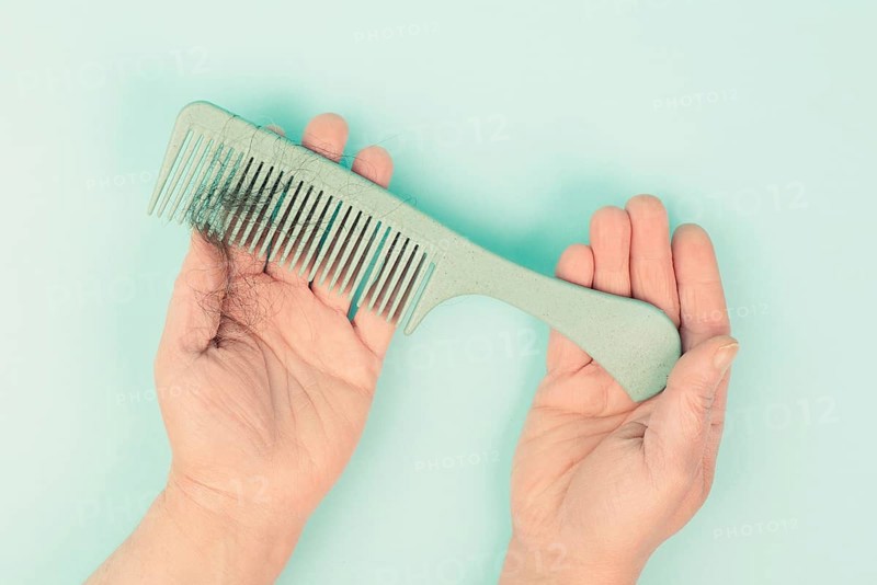 Comb with hair loss, health problem, issue of aging, alopecia areata by stress or infection, hairbrush