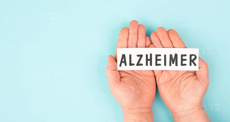 Alzheimer stands on a paper, awareness day, dementia diagnosis, ParkinsonÂ´s disease, memory loss brain disorder