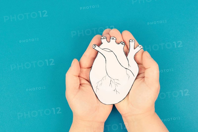 Heart attack, Myocarditis disease, inflammation of the muscle, thrombosis andcardiac stress, hands holding human organ