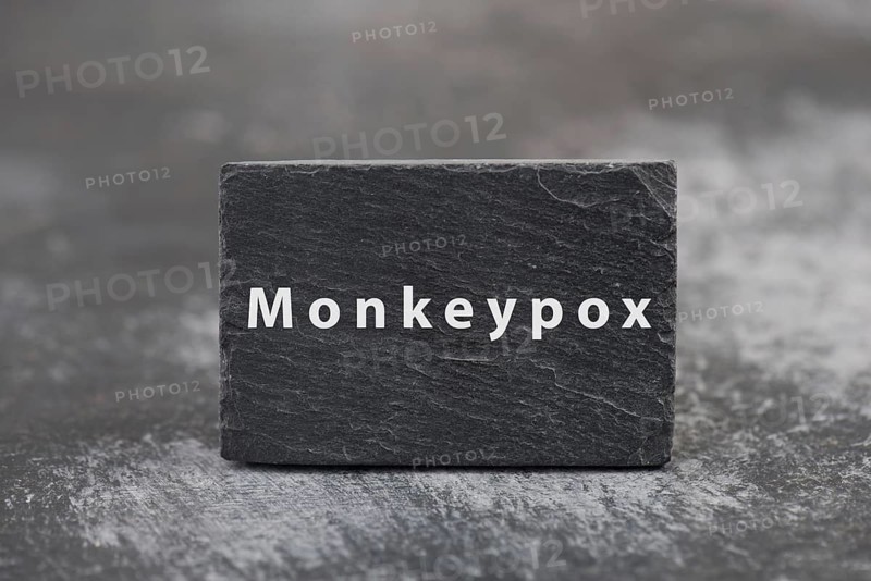 The word monkeypox is standing on a board, outbreak of the MPXV virus pandemic, infectious disease spreading