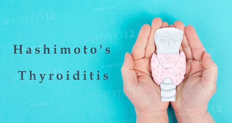 Hashimoto's thyroiditis, chronic lymphocytic disease, holding a thyroid organ, autoimmune symptoms, inflammation throat, health care