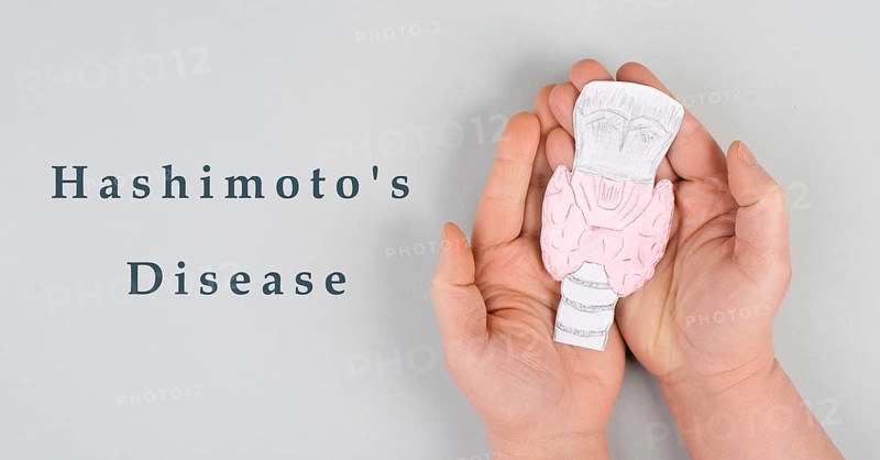 L Hashimoto's thyroiditis, chronic lymphocytic disease, holding a thyroid organ, autoimmune symptoms, inflammation throat, health care