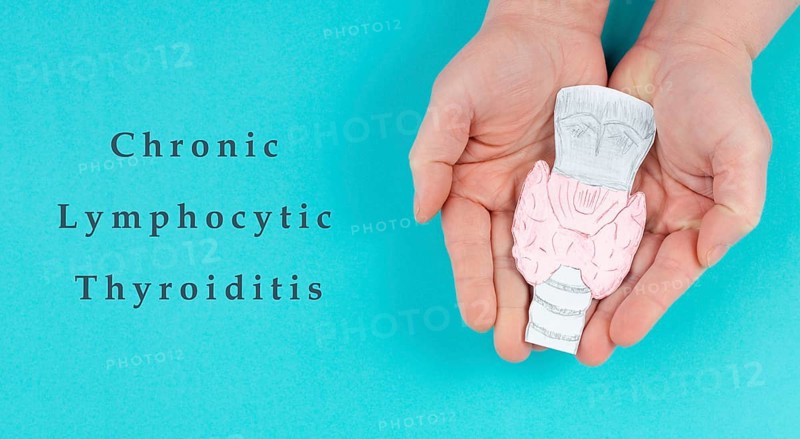 Hashimoto's thyroiditis, chronic lymphocytic disease, holding a thyroid organ, autoimmune symptoms, inflammation throat, health care