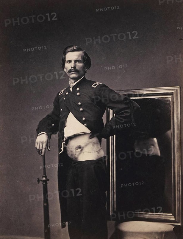 War wounded, Major H. A. Barnum, recovering from a penetrating abdominal gunshot wound with perforation of the left ilium, from the Surgical Department Photographic Catalogue, 1880, photograph by William Bell, Historic, digitally restored reproduction from an original of the period