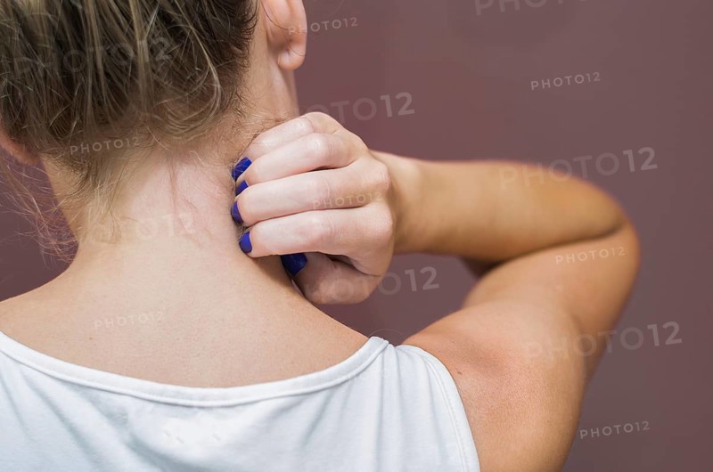 Great concept of allergy and skin diseases, young woman scratching herself