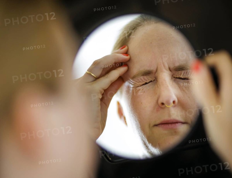 Symbolic photo on the subject of migraines and headaches. A woman rubs her aching head with her hand. Berlin, 13.08.2024