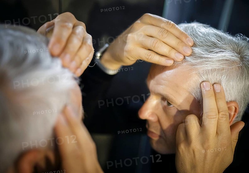 Symbolic photo on the subject of a high hairline and receding hairline. A man looks at his hairline in the mirror. Berlin, 13.08.2024