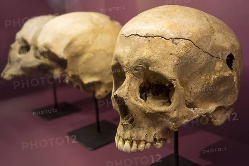 Soldier's battle scarred skull showing musket ball entry hole in the Memorial 1815 museum and remembrance venue to commemorate the bicentenary of the battle of Waterloo at Braine-l'Alleud, Belgium, Europe