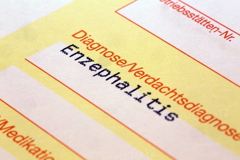 Symbolic image: Diagnosis of encephalitis on a doctor's referral. Encephalitis often occurs after corona infections, but is also one of the side effects of a corona vaccination