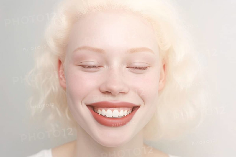 Laughing woman with Alminism with pale skin, white hair and eyelashes. KI generiert, generiert AI generated