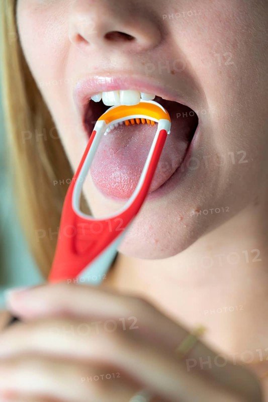 Bad breath, prevention by cleaning the tongue with a tongue brush