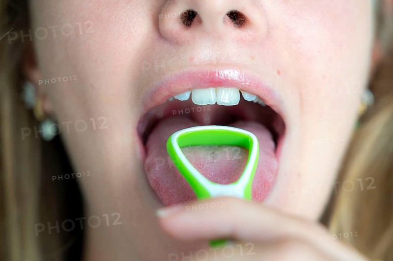 Bad breath, prevention by cleaning the tongue with a tongue brush