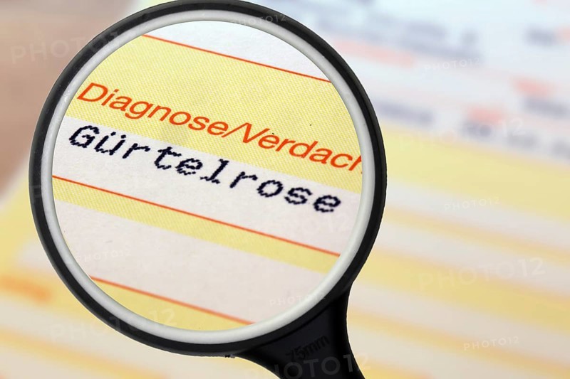 Symbolic image: Shingles diagnosis on a doctor's referral. Shingles often occurs after coronavirus infections, but is also one of the side effects of a coronavirus vaccination